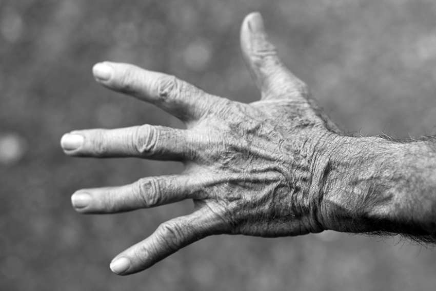 Editorial: Doctor-assisted death is a risky business
