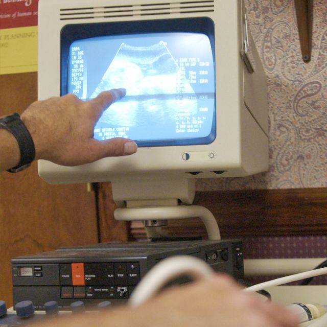 Scottish court: Midwives can't object to managing staff for abortions 