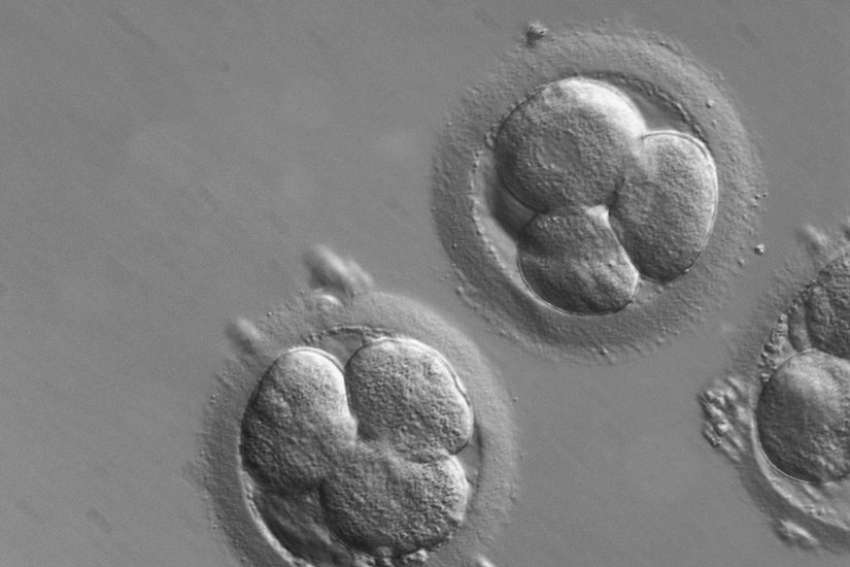 Creating babies from skin cells turns procreation into transaction: scientist