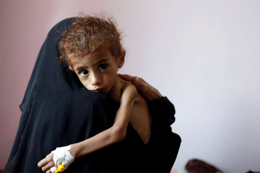 Aid groups, bishop sound alarm over humanitarian crisis affecting 21 million in Yemen