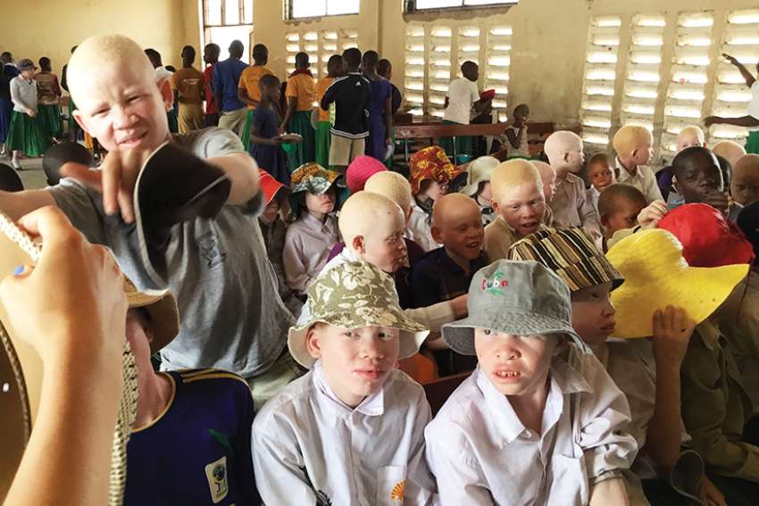Albinos’ plight sends Canadian into action
